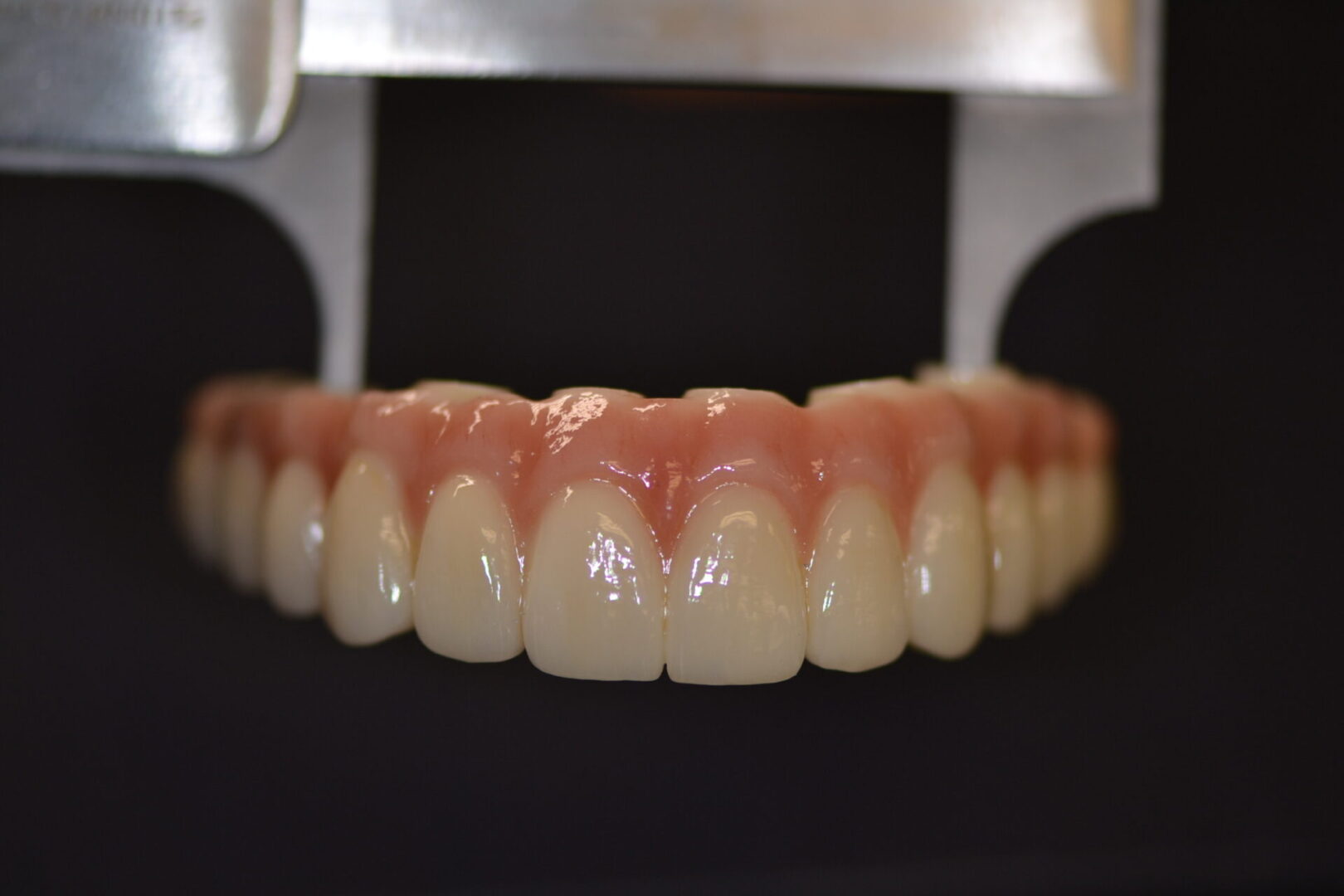 A full set of upper teeth implants