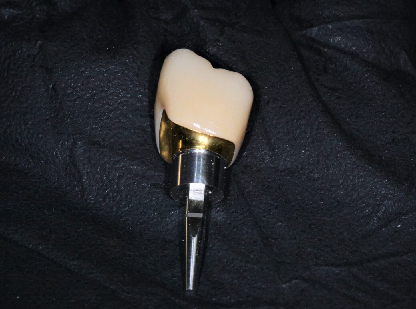 A digital tooth implant