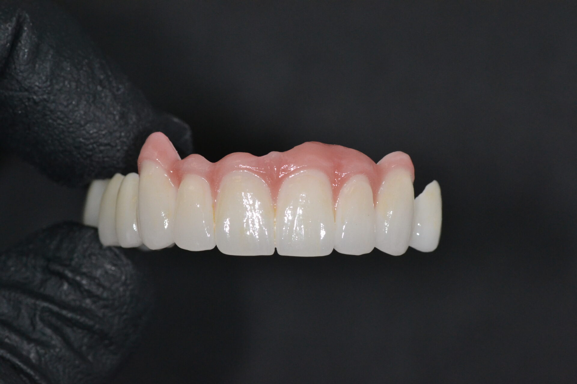 A close-up of zirconia dental implants